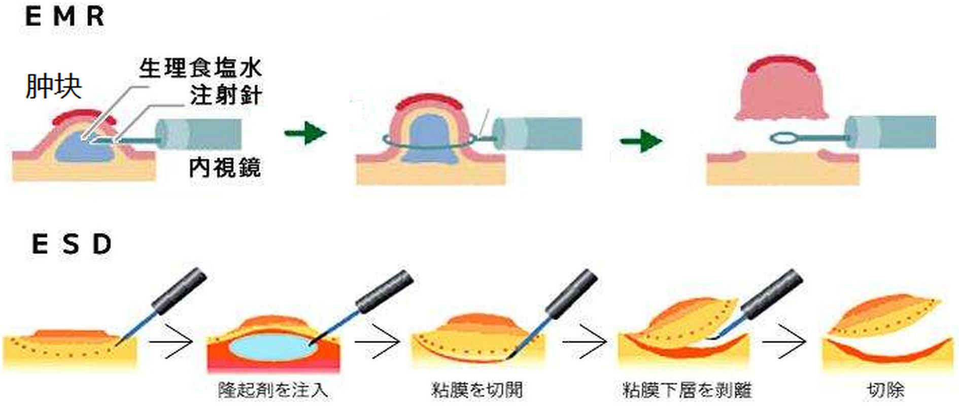 手术方法