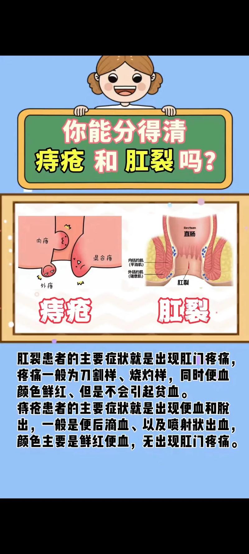 痔疮肛裂自愈难