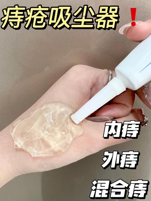 镜子真的能治痔疮吗？专业解答