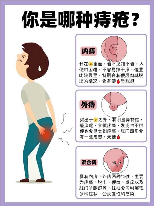 痔疮疼痛如何判断是否需要治疗？