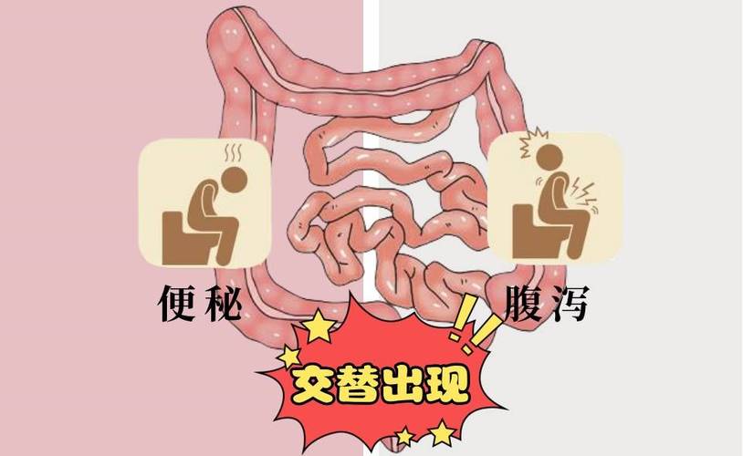 便秘腹泻