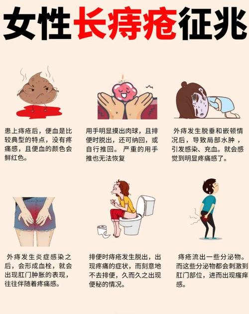 女性小痔疮是否能自行治愈？