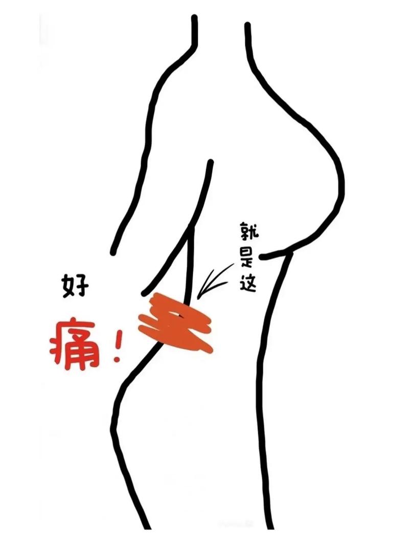 刺痛缓解