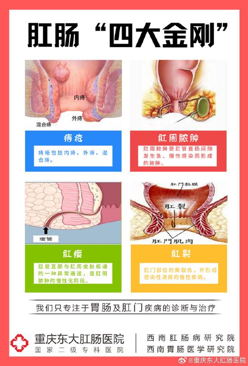 手术后肛裂再裂怎么办？