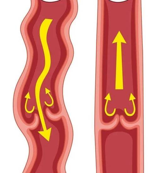静脉回流受阻