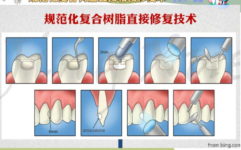 修复方法