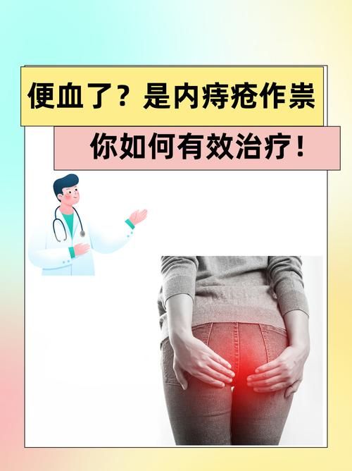 痔疮不便血是否需要治疗？