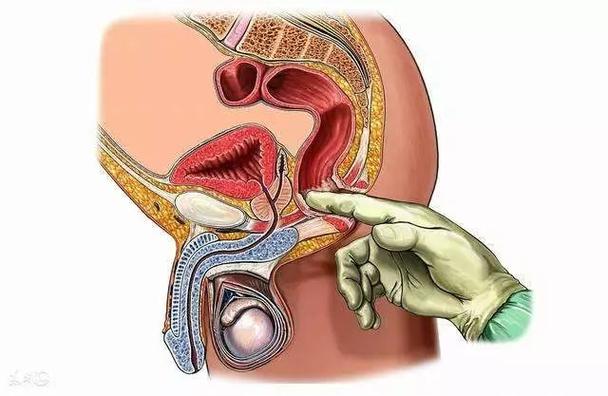 直肠指诊