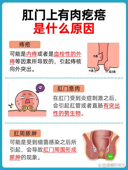 肛门插物会导致痔疮吗？