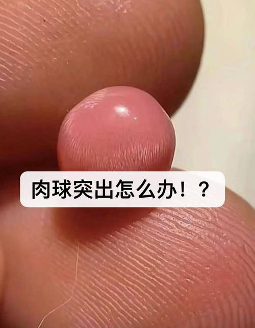 柚子皮白糖治痔疮：你试过吗？