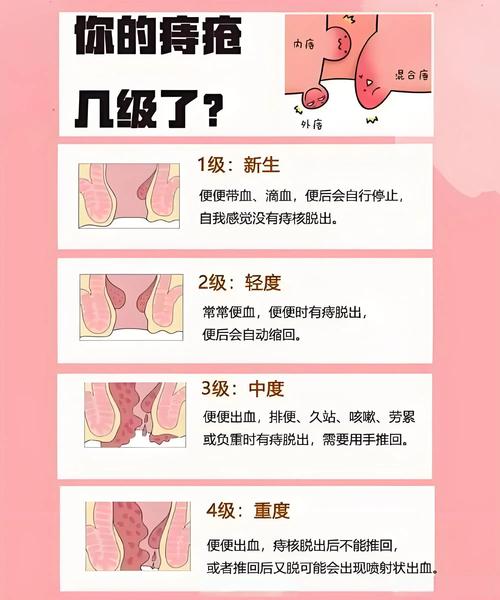 痔疮医生为何患上痔疮？