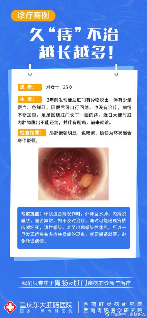 晋州痔疮治疗：选对医院很重要？