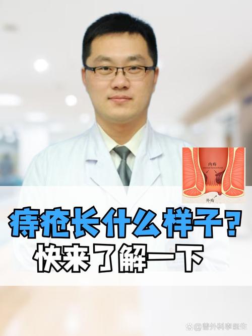 痔疮病变后，该怎么治疗？