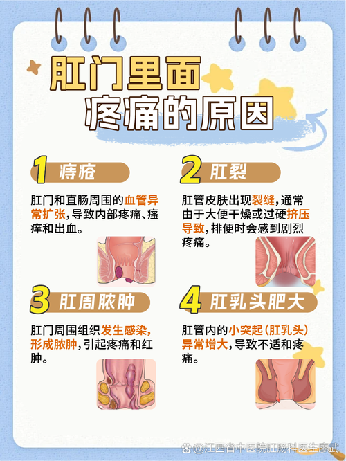 痔疮肿痛加剧，如何缓解？