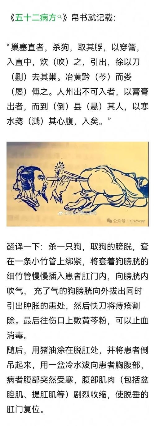 古代痔疮治疗秘法