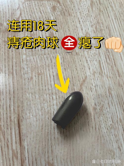 痔疮栓的新用途：能否治愈肠炎？