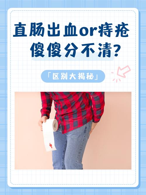 痔疮与智力：它们之间有联系吗？