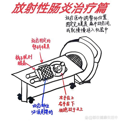 肠炎治疗