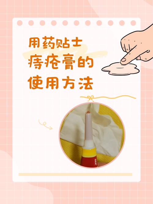 涂药治疗痔疮