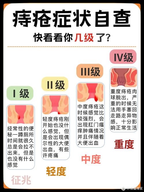 早期痔疮如何迅速治疗？